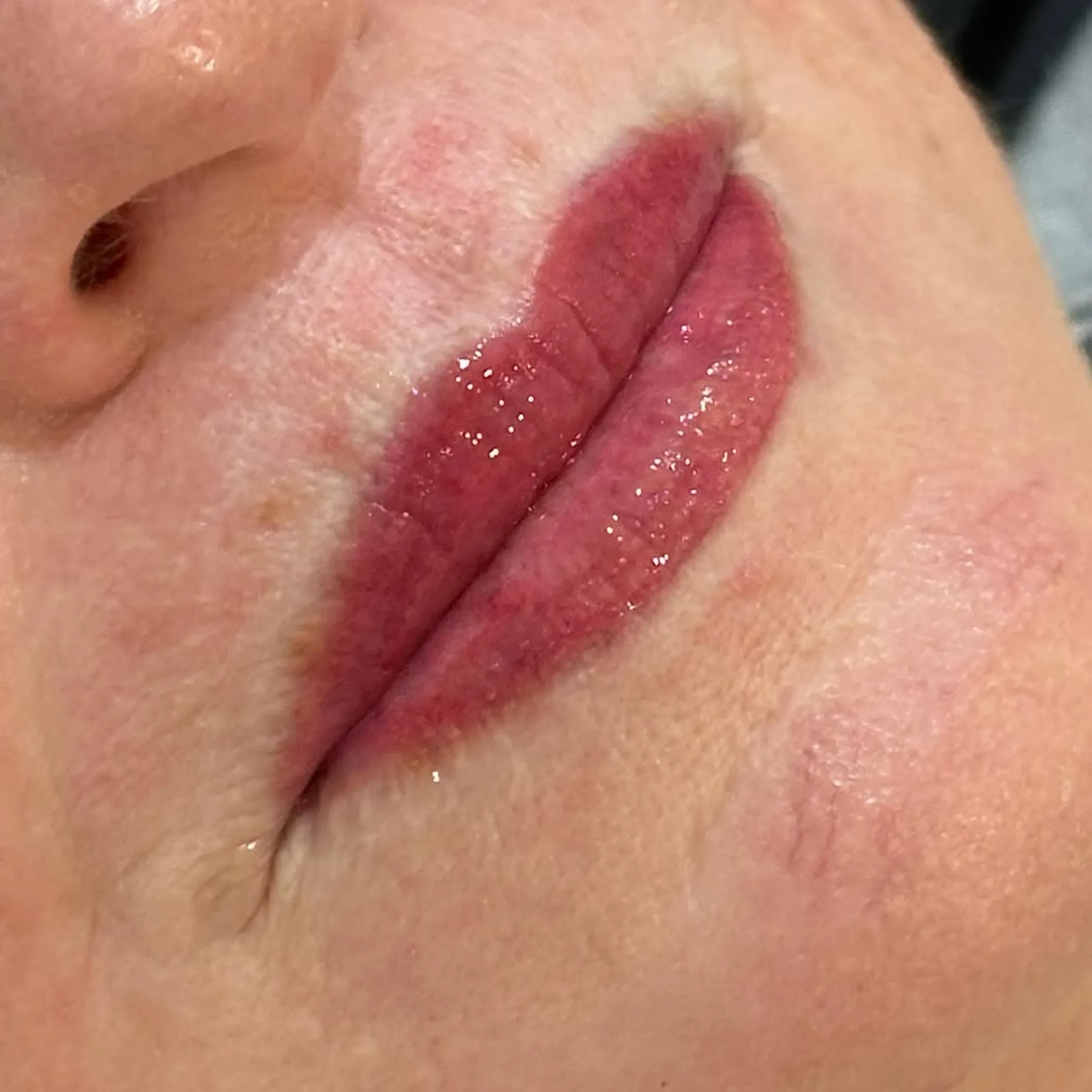 treated lips during lip blush recovery