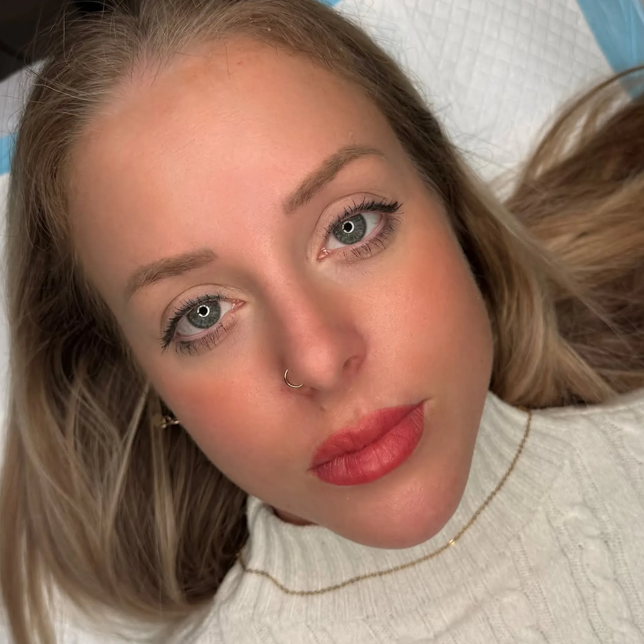 freshly treated lips